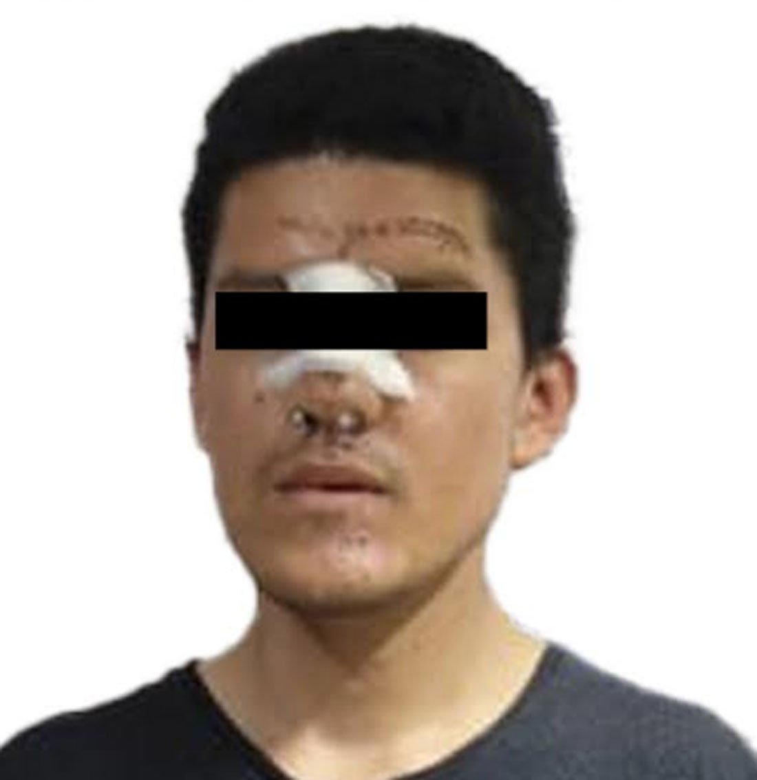 intento feminicida chimalhuacan